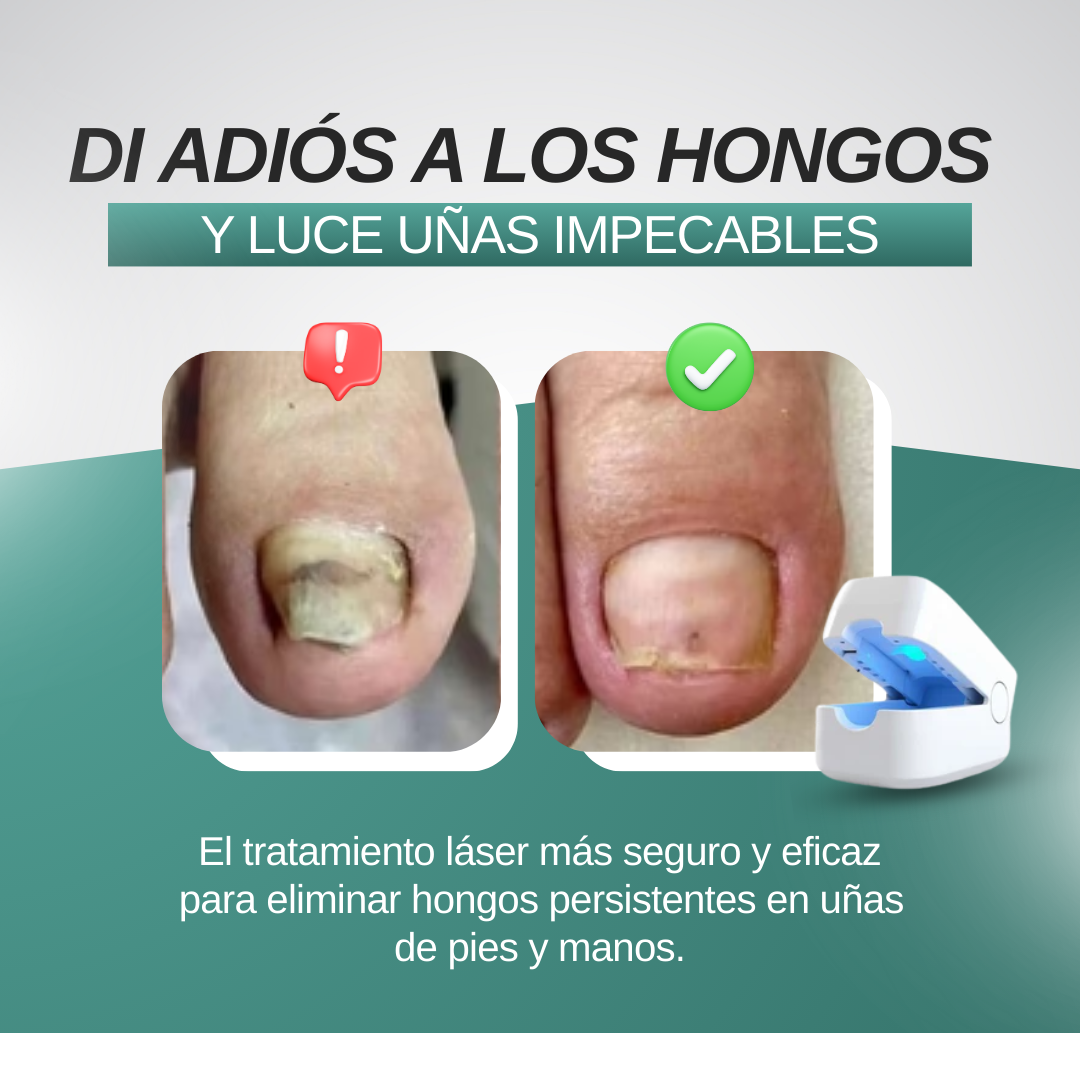 OrthoVital - Laser Anti Hongos - Compre 1 Llevate 2 GRATIS 🎁
